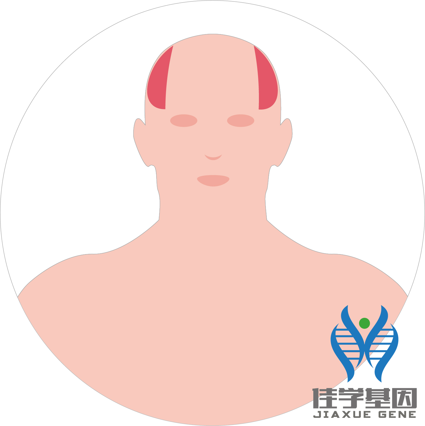 【佳學基因檢測】男性<font color='red'>脫發(fā)</font>（Androgenetic alopecia）基因解碼、<a href=http://m.vigrxplusreviewsreal.com/tk/jiema/cexujishu/2021/31933.html>基因檢測</a>